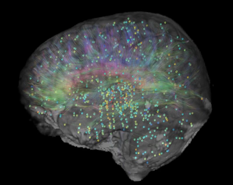 Gran aumento en la corteza cerebral podría indicar una evolución única del cerebro humano