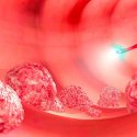 Prueban que hay distintos tipos de células dentro de un tumor