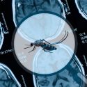 El Zika también podría tener consecuencias en el cerebro de los adultos