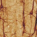 Cómo una curiosa dolencia resolvió un misterio de la neurociencia