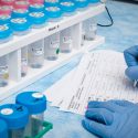 Un test epigenético identifica el 87% de los cánceres de origen desconocido