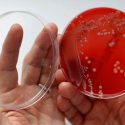Investigadores detectan primera infección en EU con preocupantes genes de «superbacteria»