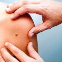 Cuba patenta nuevo medicamento para el tratamiento del cáncer de piel