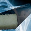 Crean biomaterial que se imprime en 3D para regenerar hueso