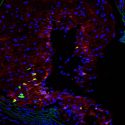 Identifican un nuevo mecanismo implicado en la aterosclerosis
