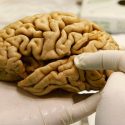 ¿Existe un vínculo entre la contaminación y el Alzheimer?