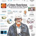 Cómo funciona la prótesis de Ray Flynn