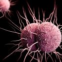 La gonorrea se hace fuerte: tiene cada vez más resistencia frente antibióticos