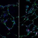 Células madre para cultivar estructuras 3D pulmonares fuera del cuerpo