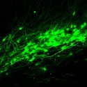 Células progenitoras para el cerebro