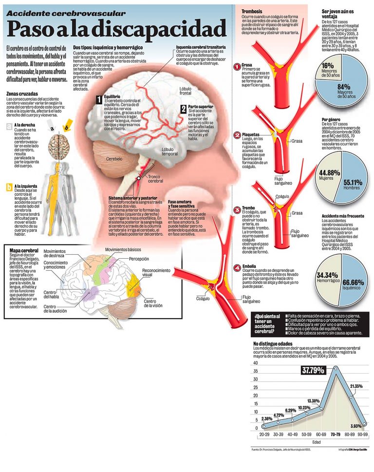 Accidente cerebrovascular. Paso a la discapacidad INVDES Accidente cerebrovascular. Paso a la discapacidad INVDES