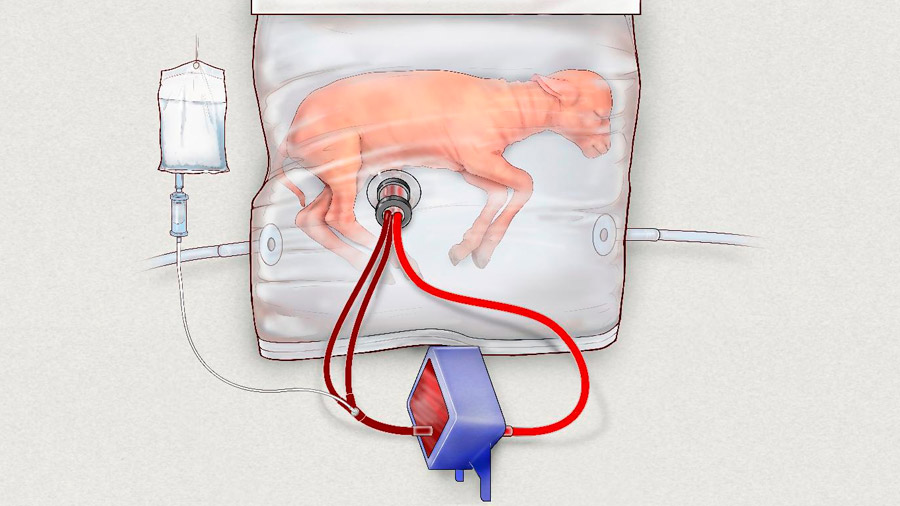 Científicos crean un "útero artificial" que podría tratar a recién nacidos extremadamente prematuros