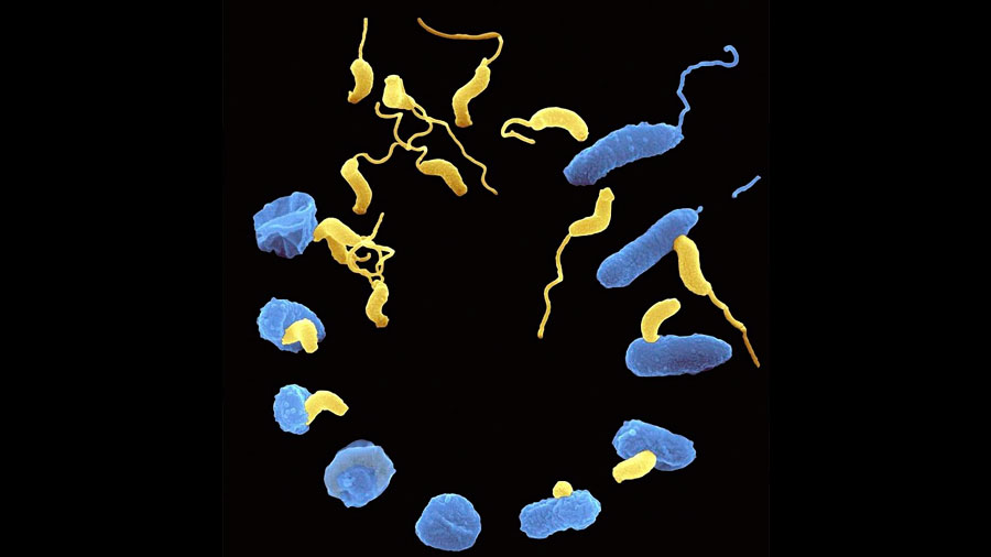 Ddellovibrio, la genial bacteria asesina que puede combatir males hasta ahora sin remedio