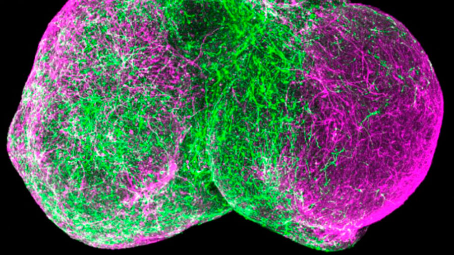 Las células madre se organizan imitando al cerebro humano