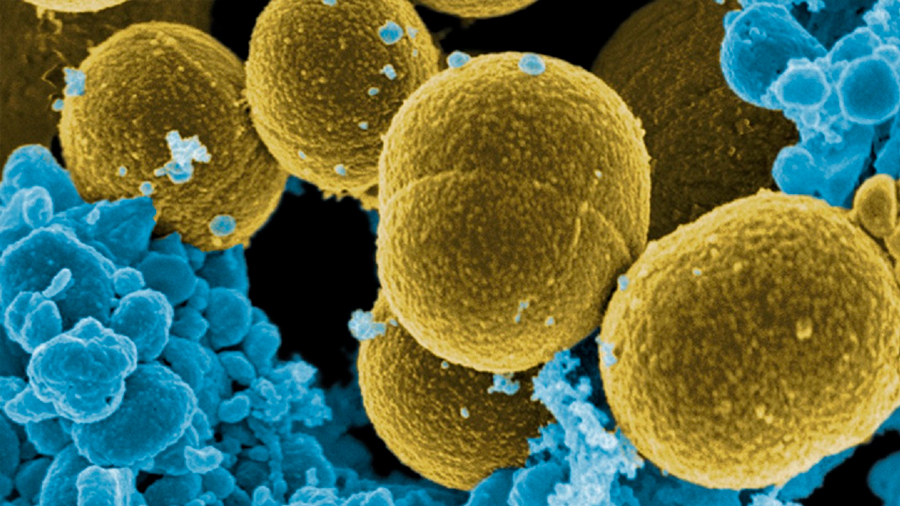 ¿Qué necesita una bacteria para infectar a otro organismo?