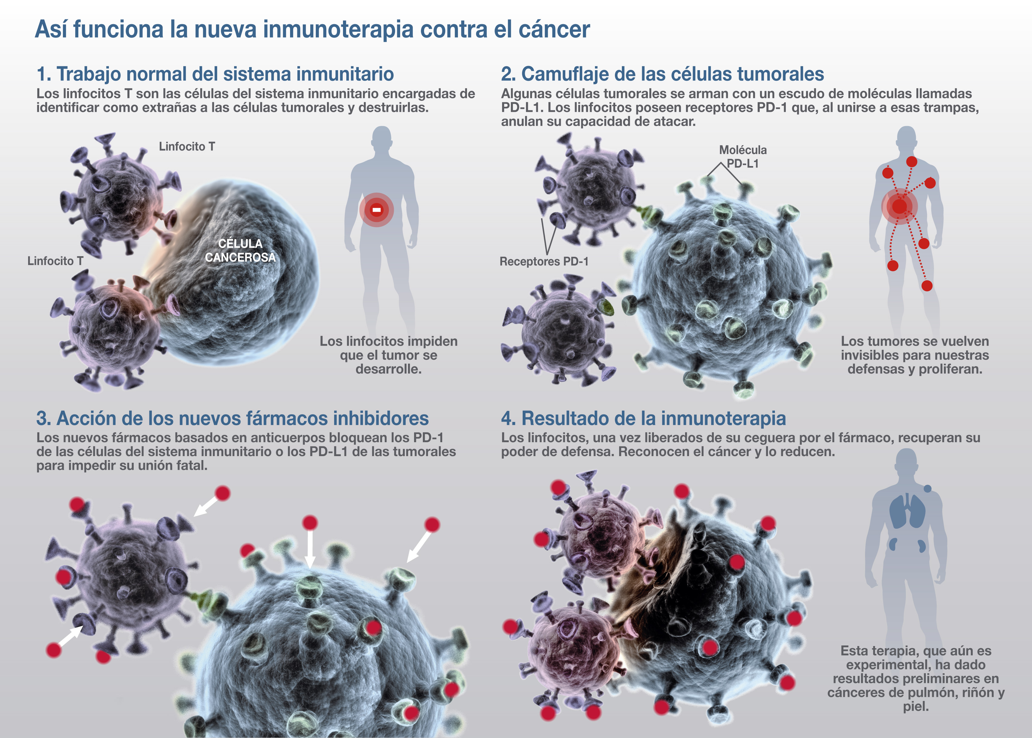 Así funciona la nueva inmunoterapia contra el cáncer