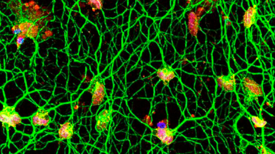 Convierten células dérmicas en neuronas