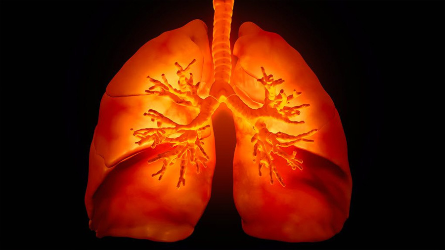 Descubren nuevo tipo de células pulmonares que luchan contra infecciones