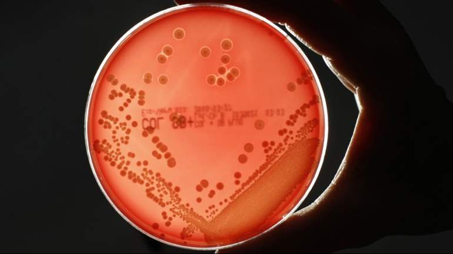 Descubren miles de nuevos microbios en nuestro cuerpo que ayudan a mantenernos sanos