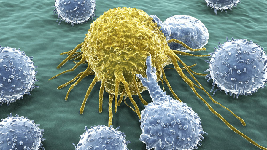 Crean nanopartículas que eliminan células cancerígenas