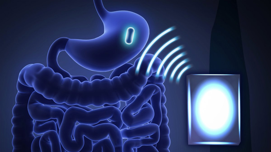 Investigadores crean un dispositivo digerible que detecta el movimiento y la digestión en el estómago