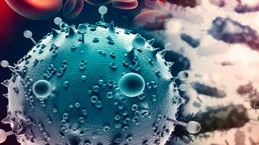 ¿El virus del sida provoca neurodegeneración?