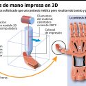 Una prótesis de mano impresa en 3D