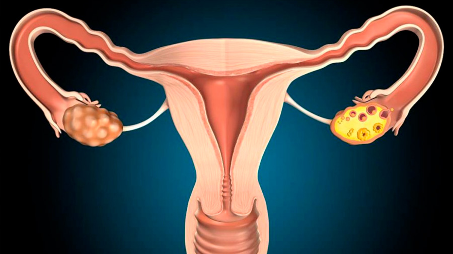 La hormona de crecimiento no solo mejora la calidad de los óvulos, también es clave para el útero