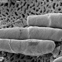 El azúcar añadido en los alimentos aumenta la virulencia de las superbacterias