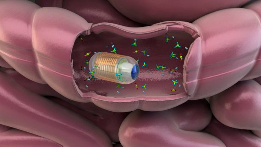 Prueban en humanos una cápsula "inteligente" que navega por el intestino para detectar enfermedades