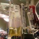 Carla, primer bebé español en recibir un trasplante cardíaco incompatible con su sangre