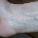 ¿Por qué tenemos las venas azules, si la sangre es roja?