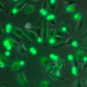El número de mitocondrias de una célula tumoral predice su sensibilidad a la quimioterapia