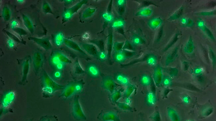 El número de mitocondrias de una célula tumoral predice su sensibilidad a la quimioterapia