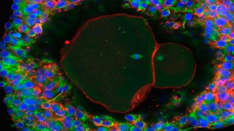 Logran científicos crear los primeros óvulos humanos de laboratorio