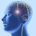 Un "marcapasos" para cerebro capaz de retardar el avance del Mal de Alzheimer