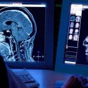 Los extraordinarios casos en los que un daño en el cerebro cambia para bien la personalidad