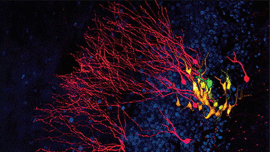 Observan por primera vez el nacimiento de una neurona