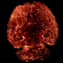 Crean un mapa de los vasos sanguíneos del cerebro