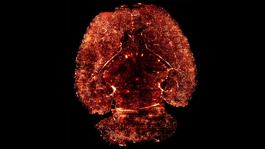 Crean un mapa de los vasos sanguíneos del cerebro