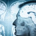 Científicos ven por primera vez todas las células de una región cerebral