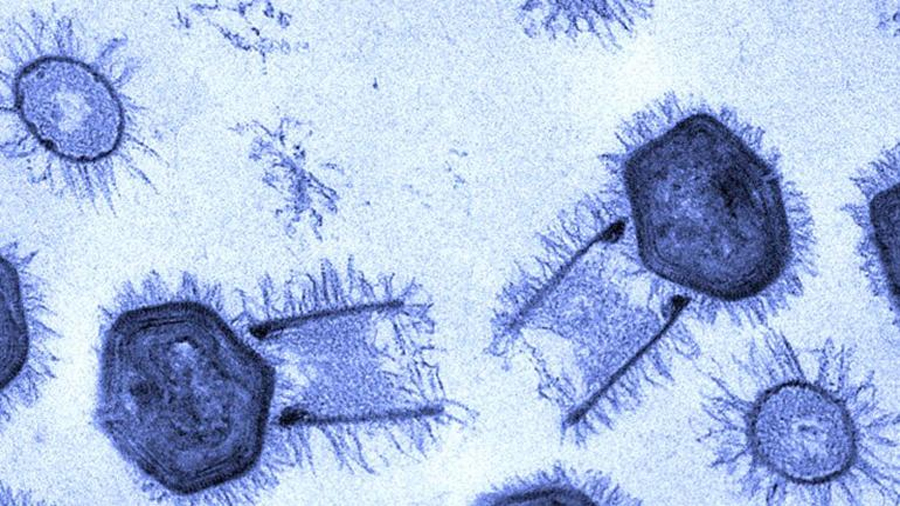 Descubren dos nuevos virus gigantes capaces de ensamblar proteínas