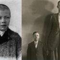 La única persona de la historia médica que pasó de enano a gigante