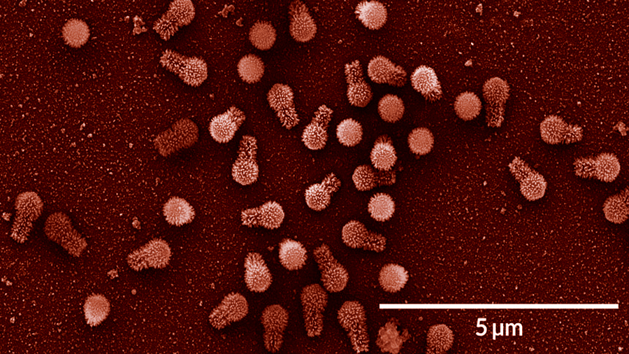 Descubren en Brasil dos nuevos virus que desafían a la biología: los más grandes de la historia