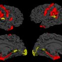 Hallan una capacidad innata del cerebro para luchar contra la esquizofrenia