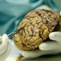 Cerebros de los ‘superancianos’ ofrecen claves sobre memoria