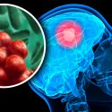 Realizan ingeniería genética a la Salmonella para que destruya tumores cerebrales