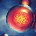 El trasplante de células madre cambia el escenario del tratamiento de la esclerosis múltiple