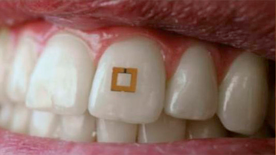 Un pequeño sensor adherido al diente rastrea lo que comes
