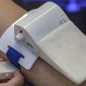 No más moretones en el brazo: Dispositivo electrónico permite sacar sangre sin dejar rastro